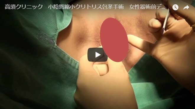 まんこが無修正で見れるYouTube動画