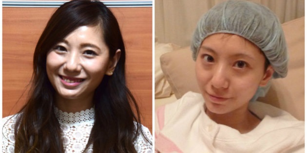 「境界悪性卵巣腫瘍」