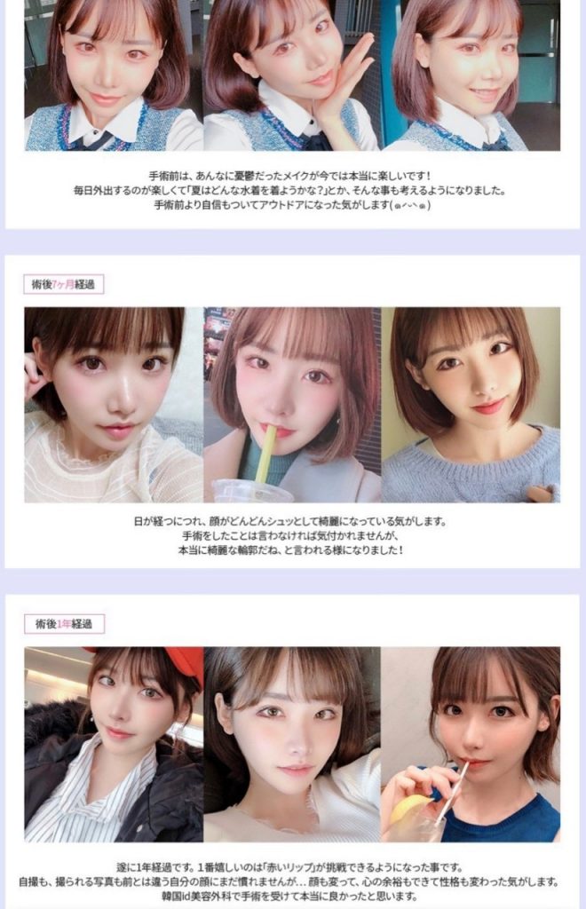 整形外科のモニターに「深田えいみ」が掲載されていた4