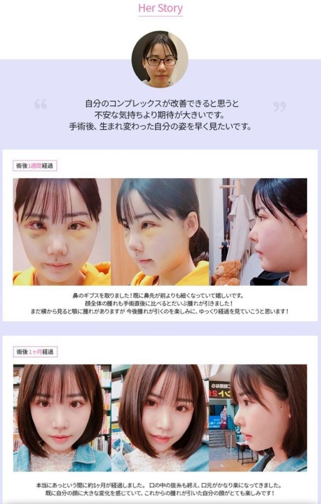 整形外科のモニターに「深田えいみ」が掲載されていた3