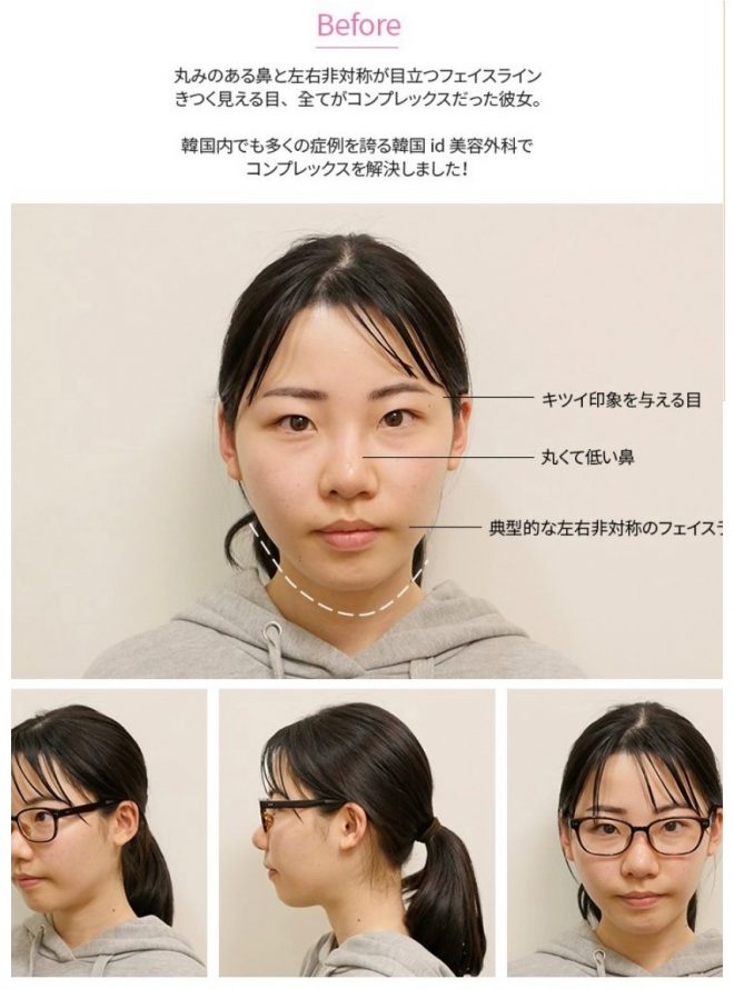 整形外科のモニターに「深田えいみ」が掲載されていた2