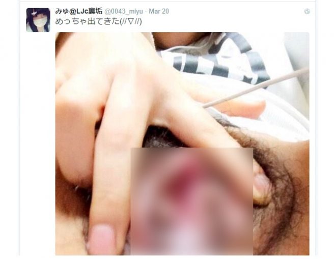 ツイッターの裏アカウントの削除済み画像を検索する方法②