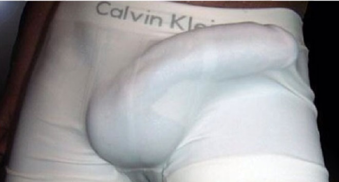 NMN HYBRIDの効果や特徴