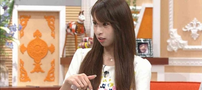 %e5%9d%82%e5%8f%a3%e6%9d%8f%e9%87%8c%e3%81%ae%e5%87%ba%e6%bc%94%e6%96%992000%e4%b8%87%e5%86%86%e3%81%af%ef%bc%9f